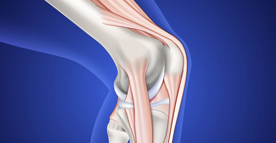 Artroscopia de rodilla por ruptura de ligamento cruzado anterior y/o posterior