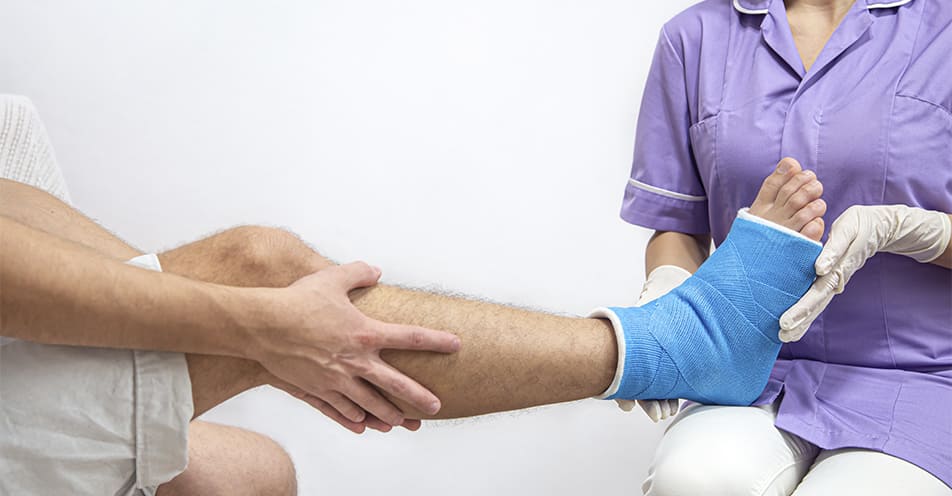 Colocación de yeso para fracturas