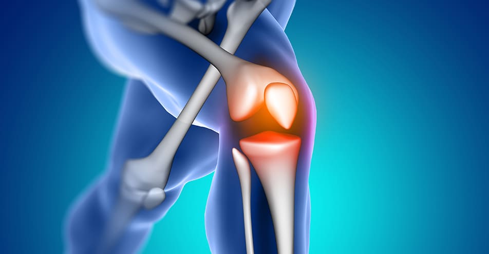Prótesis de rodilla